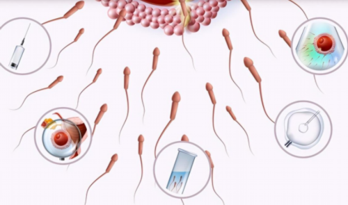 代孕成功率2026_国内三代试管靠谱吗,男性带y染色体的精子喜欢酸性还是碱性体