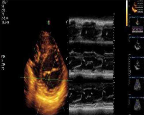 供卵包助孕包生男孩_武汉试管代怀生,试管婴儿和正常的婴儿一样吗湖北武汉