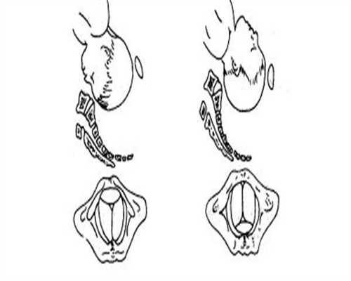 夫妻染色体检查费用需要多少钱？染色体检查项目都有哪些？