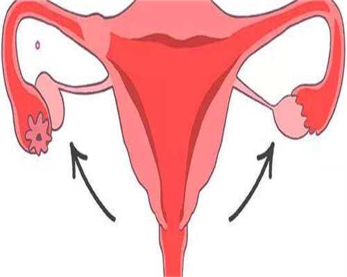 38岁双胎妊娠。一个胚胎接近疤痕子宫，是否要减胎？