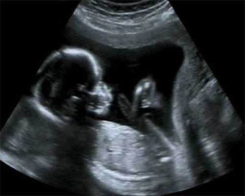 代孕中介哪里最安全-武汉公立医院供卵要求_子宫壁薄 影响怀孕，又该如何调理